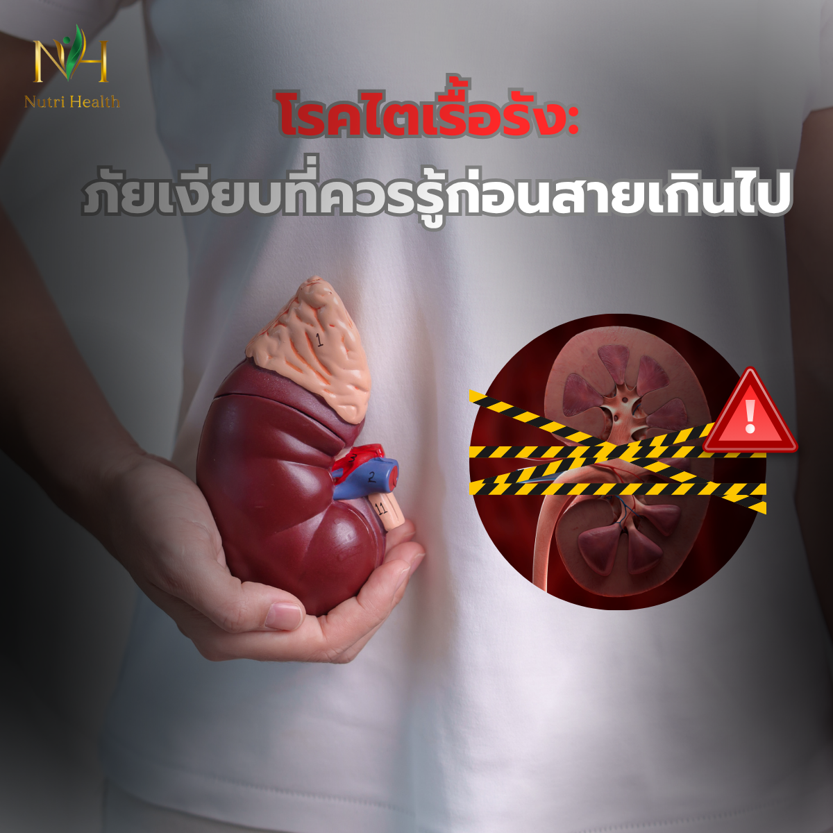 โรคไตเรื้อรัง: ภัยเงียบที่ควรรู้ก่อนสายเกินไป