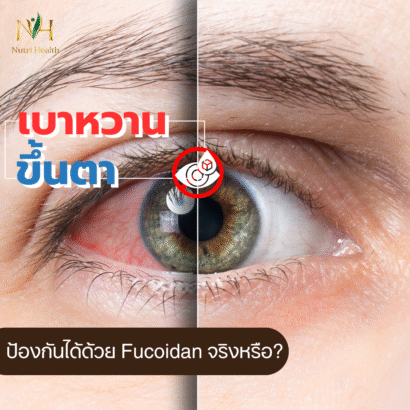 เบาหวานขึ้นตา ป้องกันได้ด้วย Fucoidan จริงหรือ?